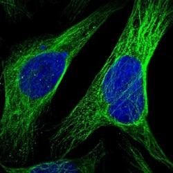 CCDC57 Antibody, Novus Biologicals:Antibodies:Primary Antibodies